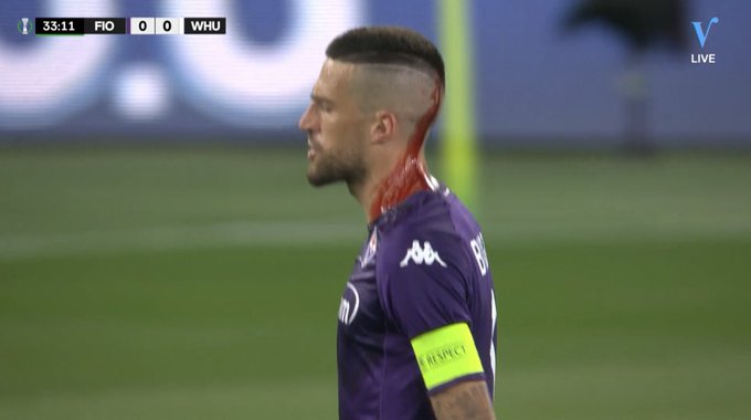 turunminum.id Hari Buruk Biraghi, Gagal Bawa Fiorentina Juara Conference League, Malah Kepala Bocor Akibat Ulah Fans West Ham